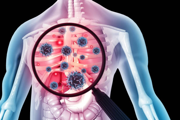 Anti-allergic / Respiratory tract Solutions